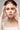 mujer con acné facial